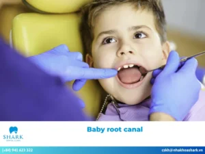 Baby root canal