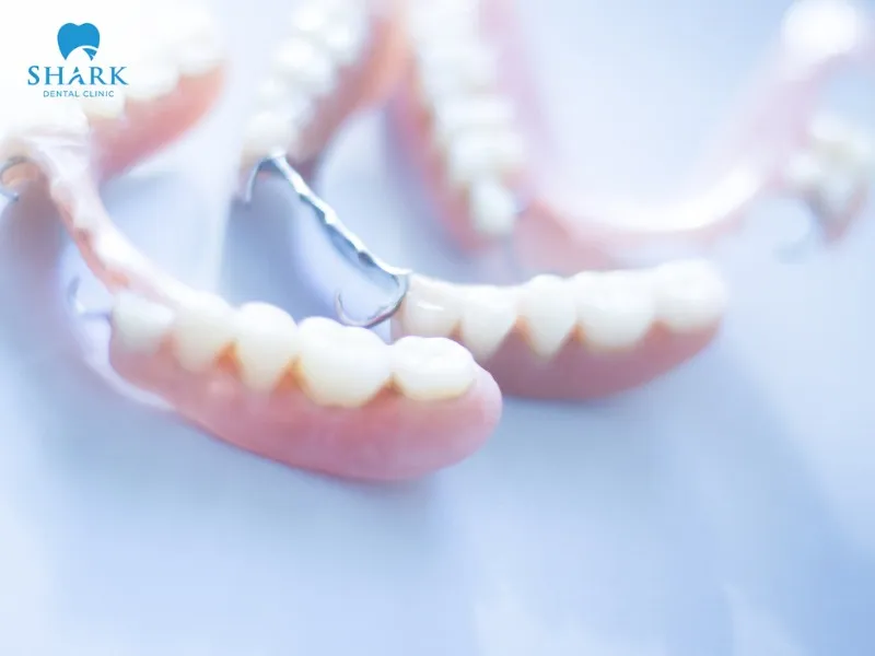 Both acrylic and porcelain teeth are common dental materials used in partial dentures