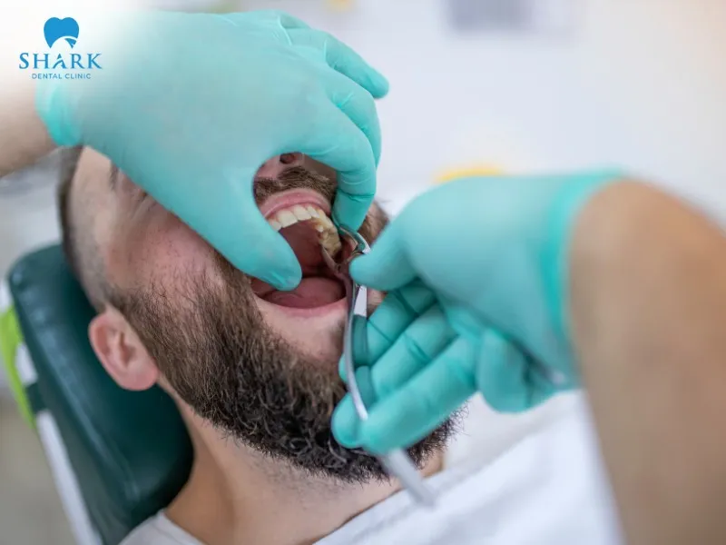 You should consider extracting a root canal-treated tooth if it is chipped, structurally damaged, severely infected, or poses a risk to adjacent teeth