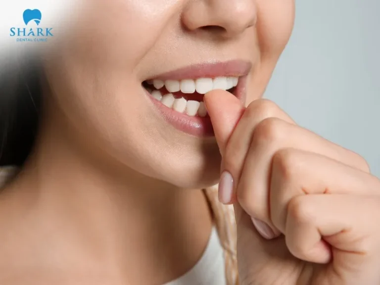 Nail-biting is a bad habit that over time can loosen the implant post and reduce its stability