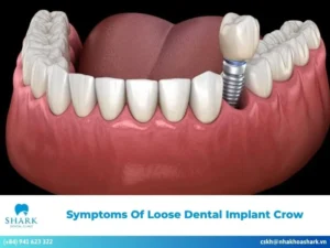 Symptoms of loose dental implant crow