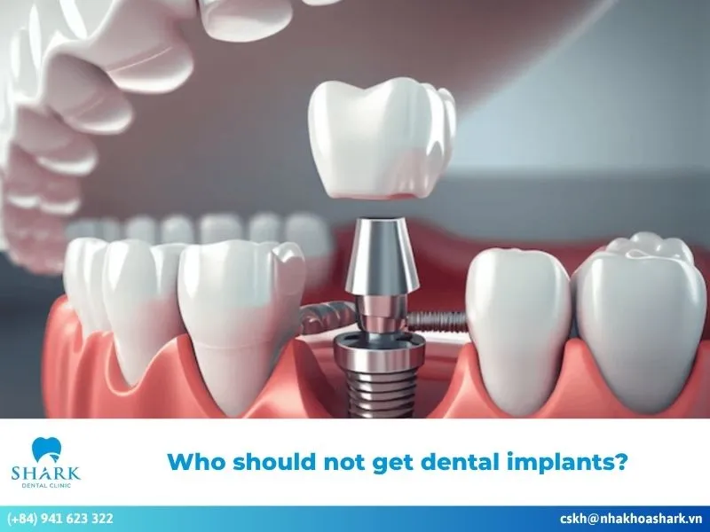 Who should not get dental implants