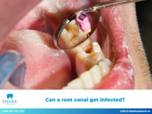 Can a root canal get infected