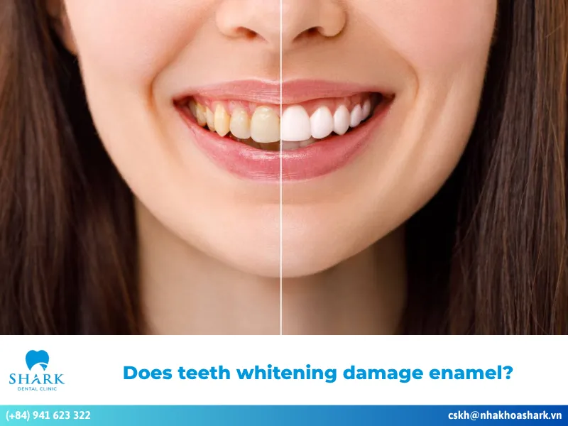 Does teeth whitening damage enamel