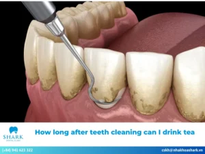 How long after teeth cleaning can I drink tea