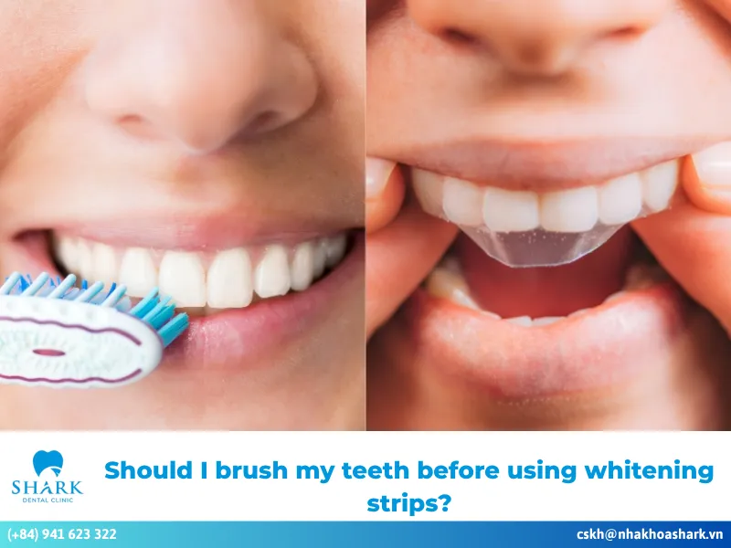 Should i brush my teeth before using whitening strips?