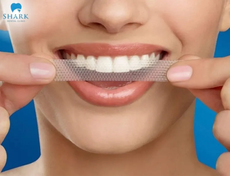 Teeth whitening during pregnancy usually yields poor results and is not recommended