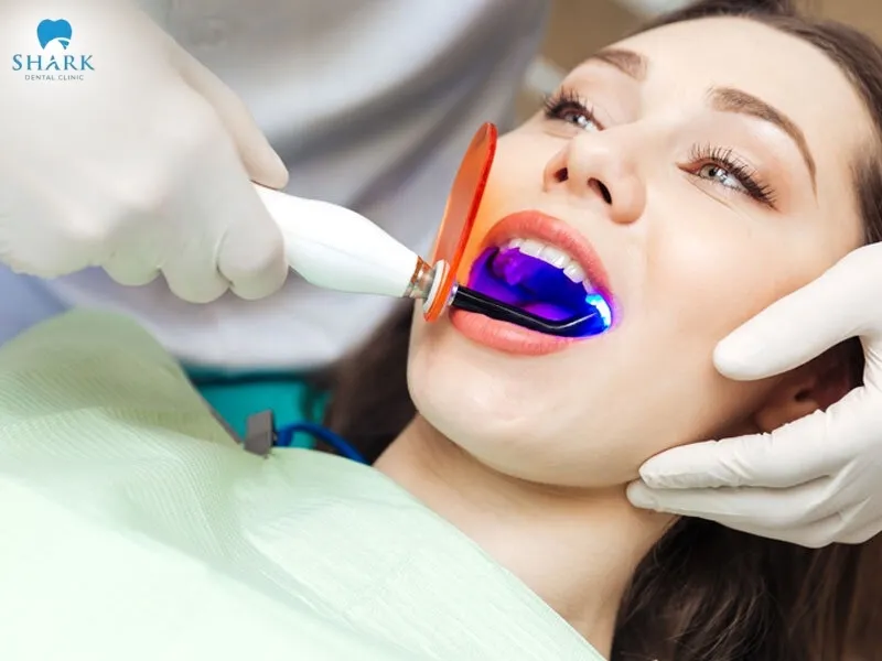 Performing teeth whitening carelessly or without precision is one of the causes that make the gums more prone to burns and irritation