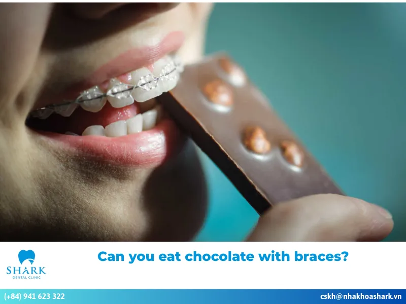 can you eat chocolate with braces