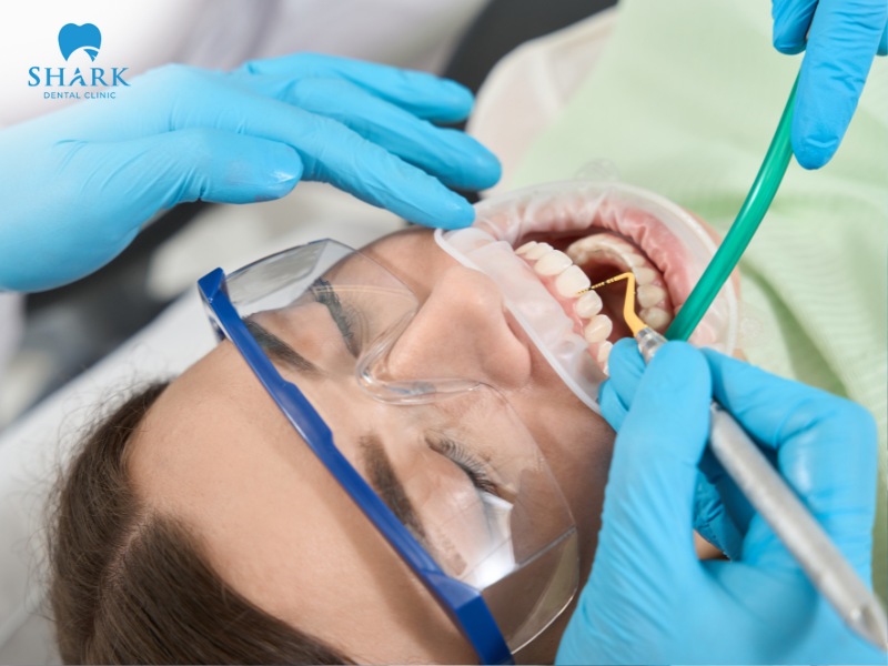 At reputable dental clinics, the cost of ultrasonic teeth cleaning ranges from 100,000 to 500,000 VND