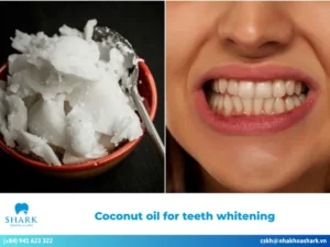 coconut oil for teeth whitening