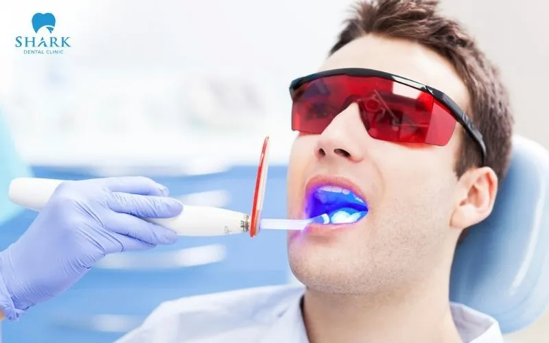 Teeth whitening is a cosmetic dental method that uses whitening agents to make your teeth brighter and whiter