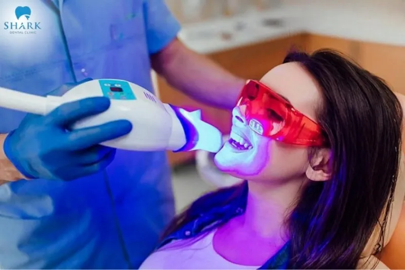 Choosing a professional teeth whitening treatment at a reputable dental clinic helps prevent potential damage to tooth enamel