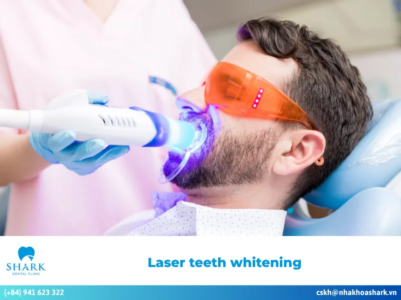 laser teeth whitening