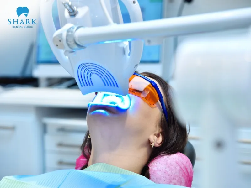 You can return to your normal diet about 5–7 days after teeth whitening