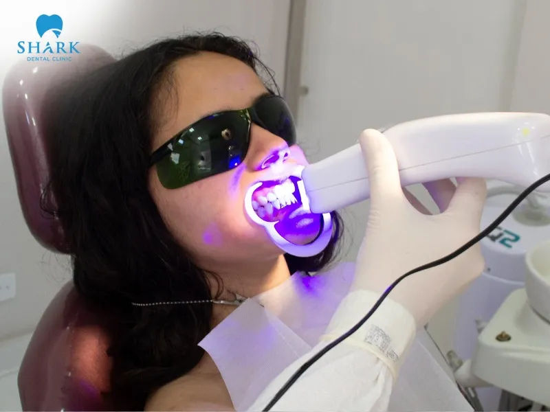 After teeth whitening, you should maintain a healthy diet to preserve the aesthetic results and protect your tooth enamel