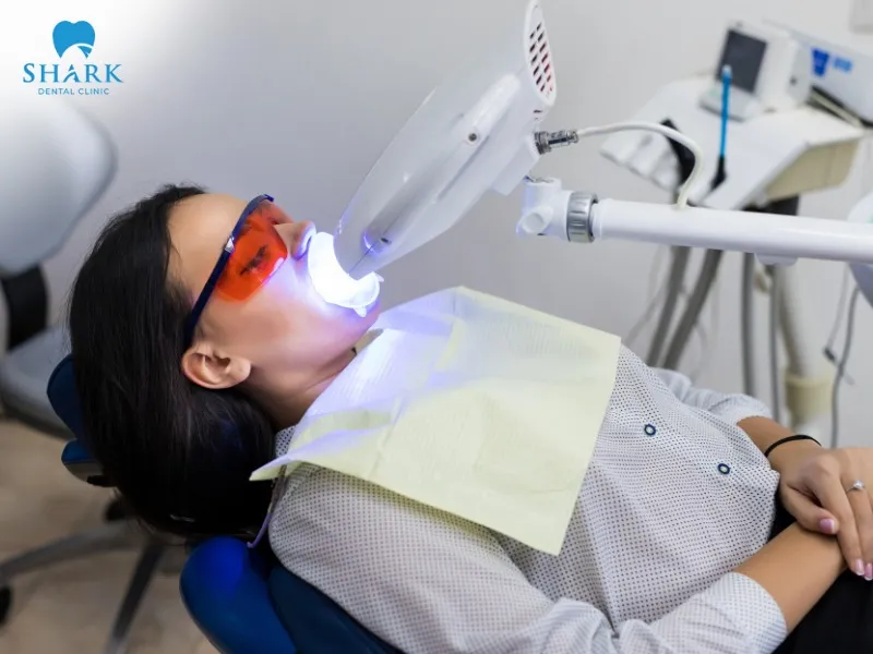 Laser teeth whitening delivers fast and long-lasting results
