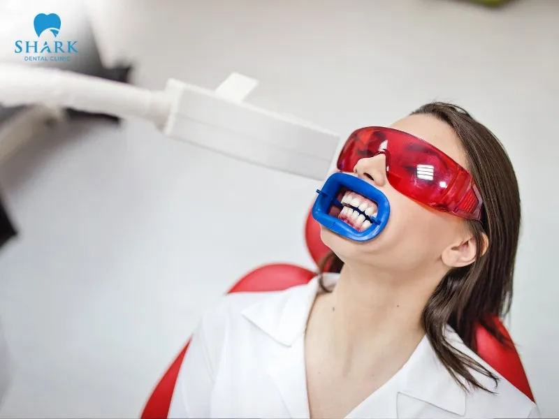 The cost of teeth whitening in Vietnam typically ranges from 2,000,000 to 4,000,000 VND per session