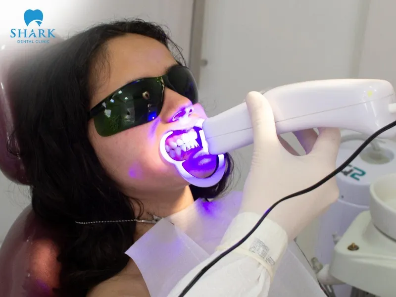 Is teeth whitening covered by insurance?