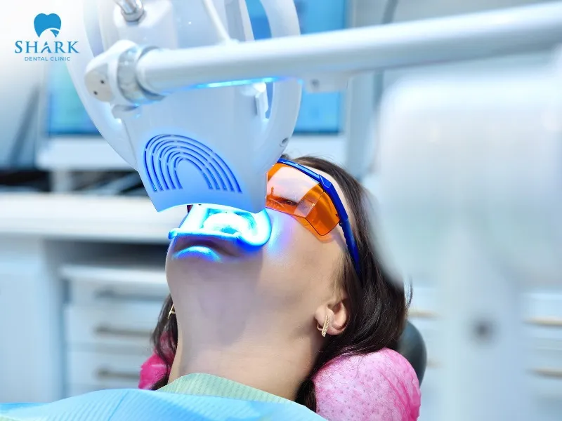 The cost of teeth whitening at dental clinics typically ranges from 1,000,000 to 4,000,000 VND per session