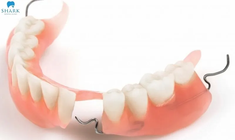 Partial dentures are a type of removable denture used to restore multiple missing teeth or an entire set of lost teeth