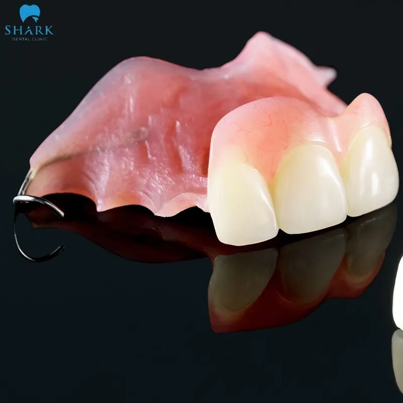 This missing teeth replacement method is suitable for various tooth loss conditions, especially cases with multiple missing teeth in alternating positions on the same dental arch