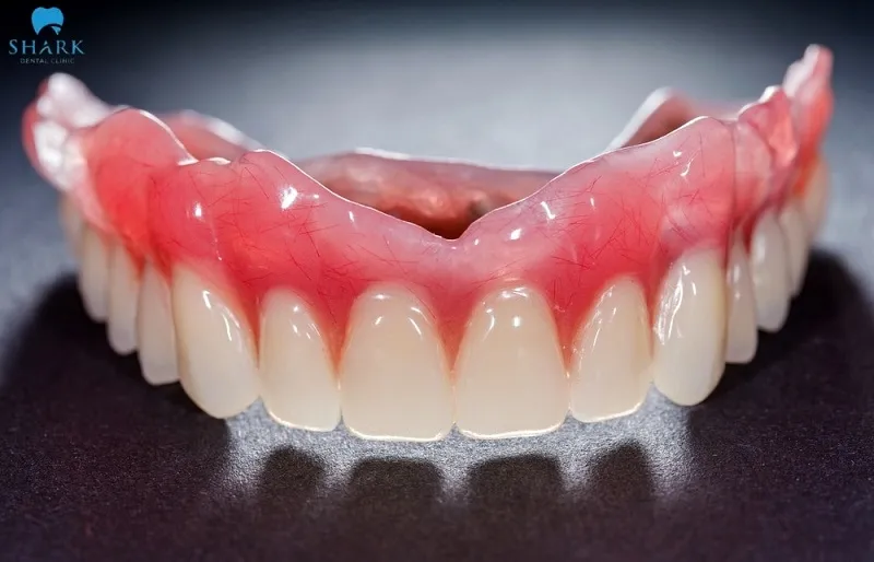 Immediate dentures help restore chewing function and aesthetics during the waiting period for dental crowns or permanent dentures
