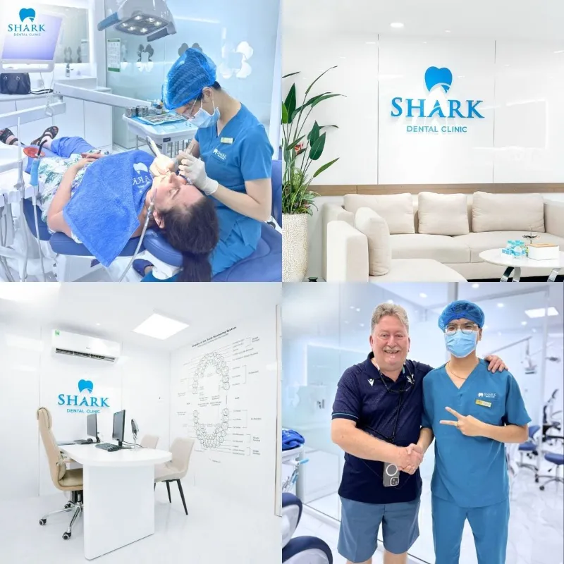 Shark Dental Clinic is a trusted dental clinic chosen by many customers for their oral care needs