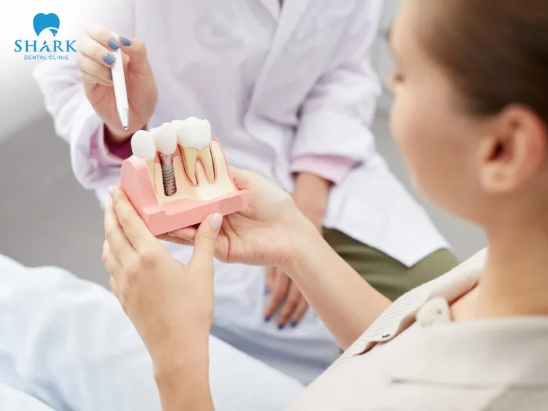 Around 3 to 6 months after dental implant placement, you can eat normally, but it’s best to continue prioritizing soft and easy-to-swallow foods