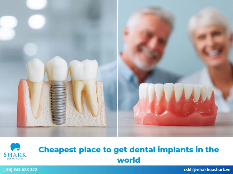 Cheapest place to get dental implants in the world