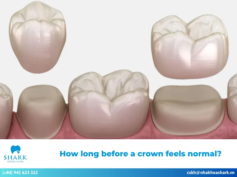 How long before a crown feels normal after restoration?