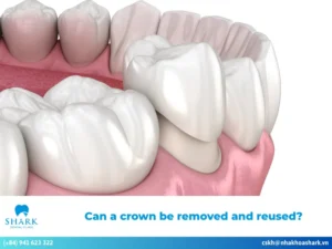 Can a crown be removed and reused?