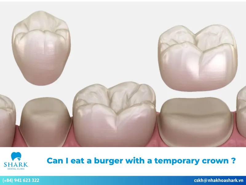 Can I eat a burger with a temporary crown?