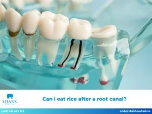 Can i eat rice after a root canal?