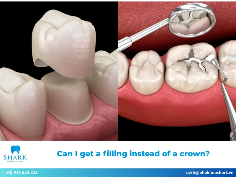 Can I get a filling instead of a crown?
