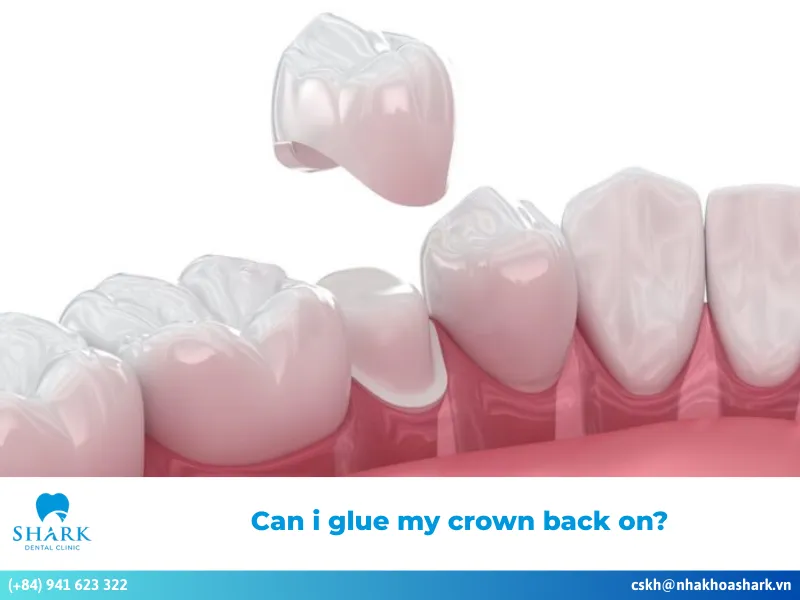 Can I glue my crown back on?