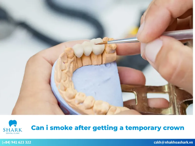 Can I smoke after getting a temporary crown?