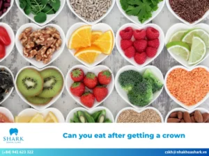 Can you eat after getting a crown