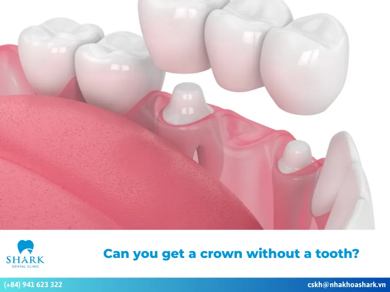 Can you get a crown without a tooth
