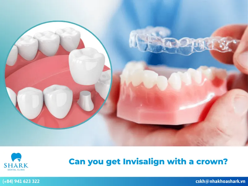 Can you get Invisalign with a crown?