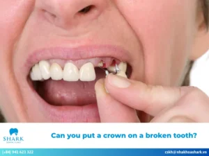 Can you put a crown on a broken tooth