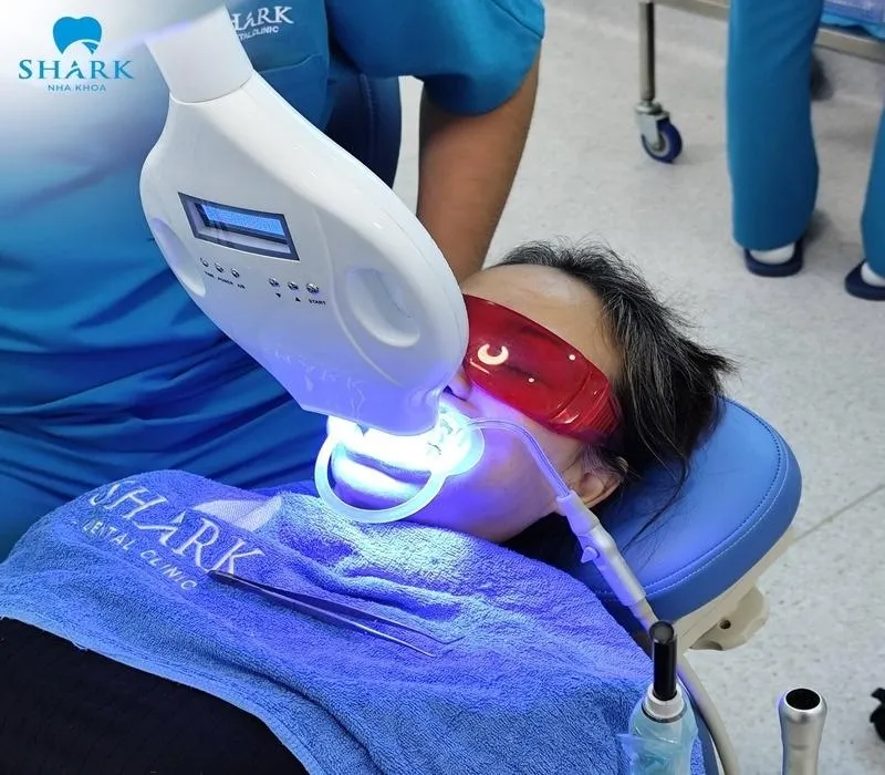 Teeth whitening is a suitable solution for people with yellowed or discolored teeth