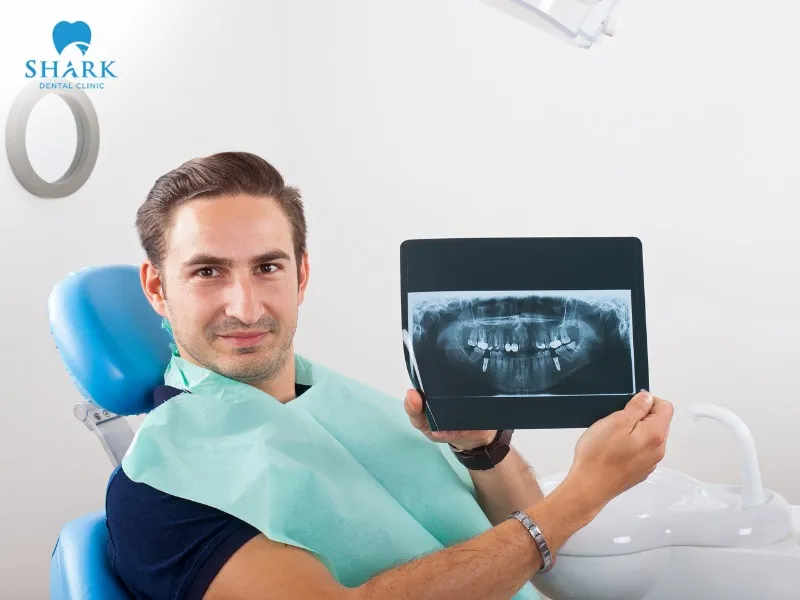 X-ray images show noticeable changes after root canal treatment and abscess management over a period of several months