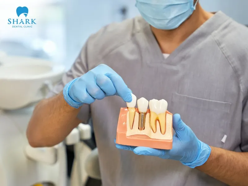 In cases where a tooth must be extracted due to abscess or infection, the dentist will recommend that the patient consider getting a dental implant or prosthetic replacement