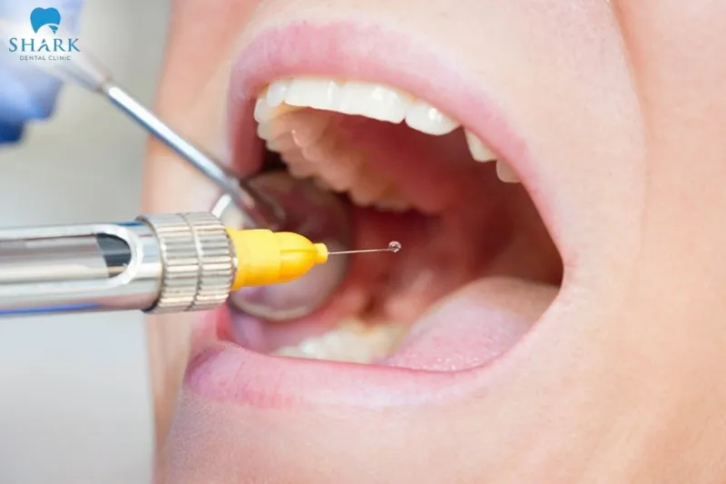With the question do they numb you for a crown, the answer is yes in most cases to help the tooth-preparation process take place smoothly and without pain