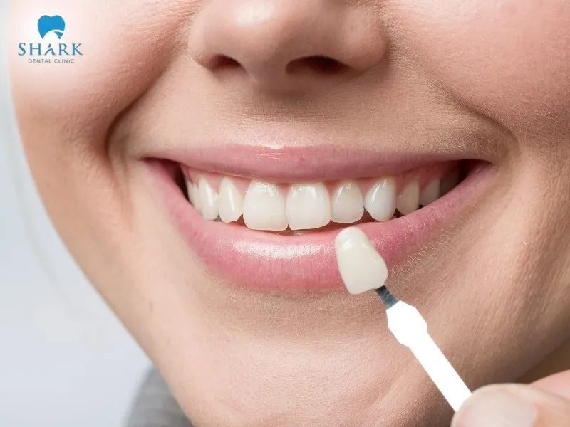 Dental services that are purely cosmetic and not related to treatment, such as porcelain veneers, are not eligible for HSA coverage