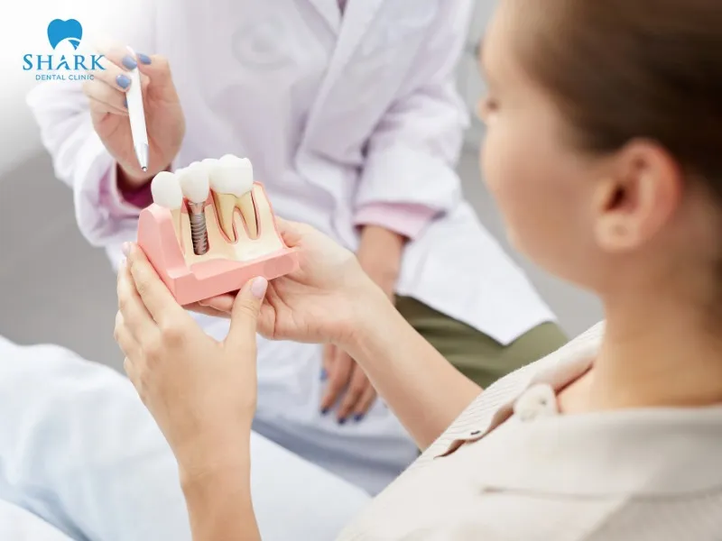 Attaching a crown onto the implant post ensures full chewing function, communication, and overall aesthetics for your smile