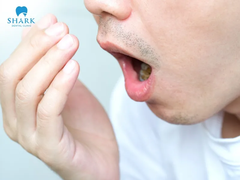 Smoking regularly can cause extremely unpleasant bad breath