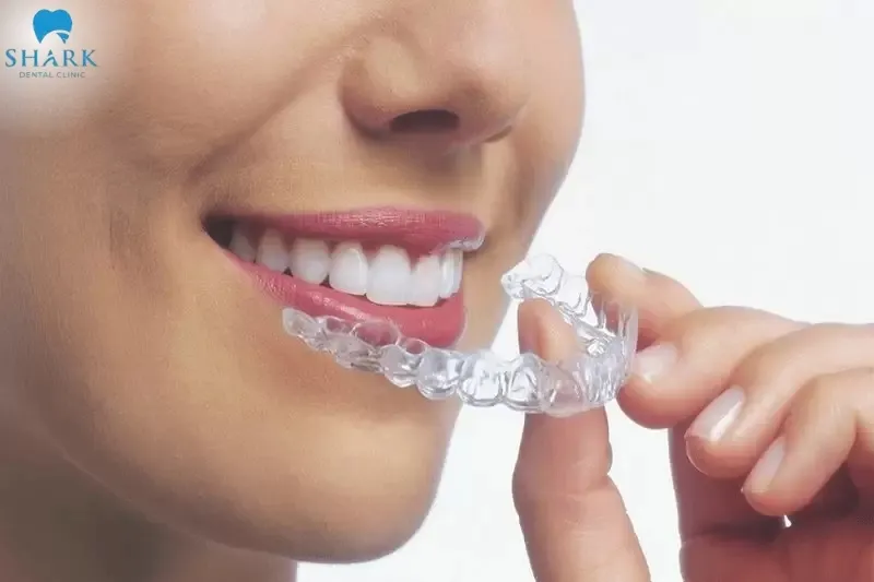 Can you get Invisalign with a crown? The answer is yes, but you will face several challenges such as the aligners being more prone to shifting