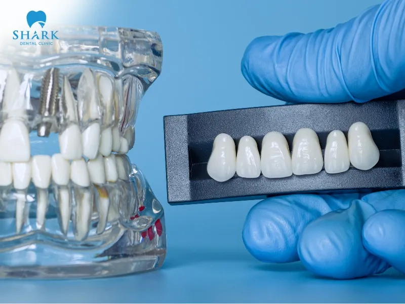 If you find the fallen crown, make sure to rinse it thoroughly to remove dirt and leftover food particles